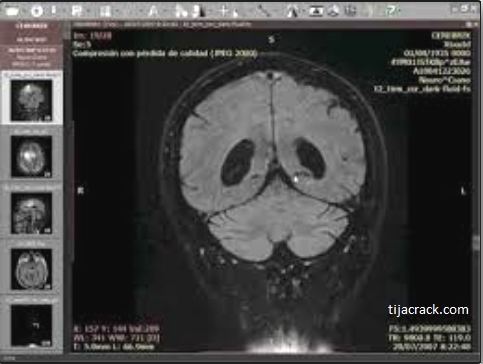 radiant dicom viewer free download for mac