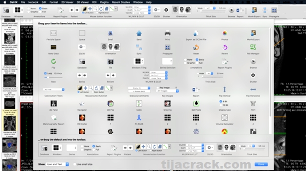 OsiriX MD Crack